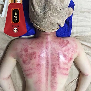 黃飛鴻小佰草抑菌液案例