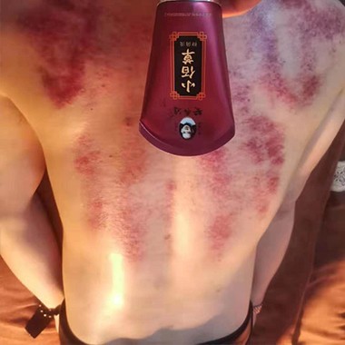 黃飛鴻小佰草抑菌液案例