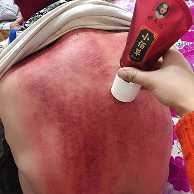 黃飛鴻小佰草抑菌液案例