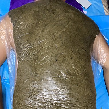 黃飛鴻熱灸膏使用案例