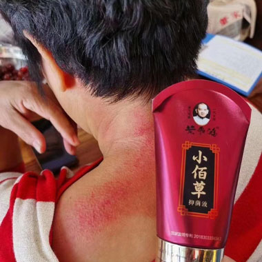 黃飛鴻小佰草抑菌液案例